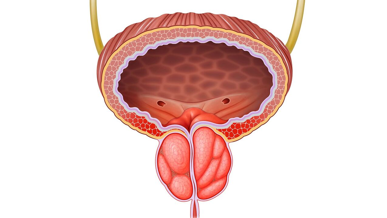 geschwollene Prostata